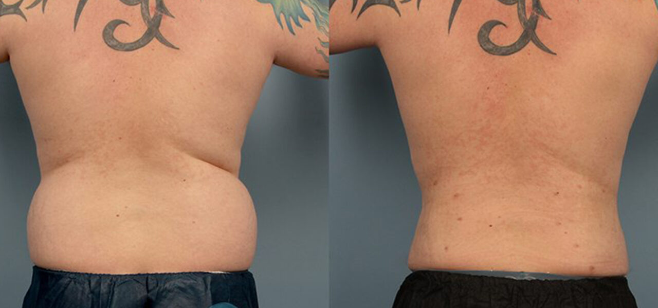 Body Contouring Weight Loss Centers of Huntsville